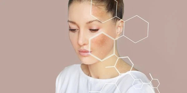 les bienfaits du chocolat noir sur la peau peau